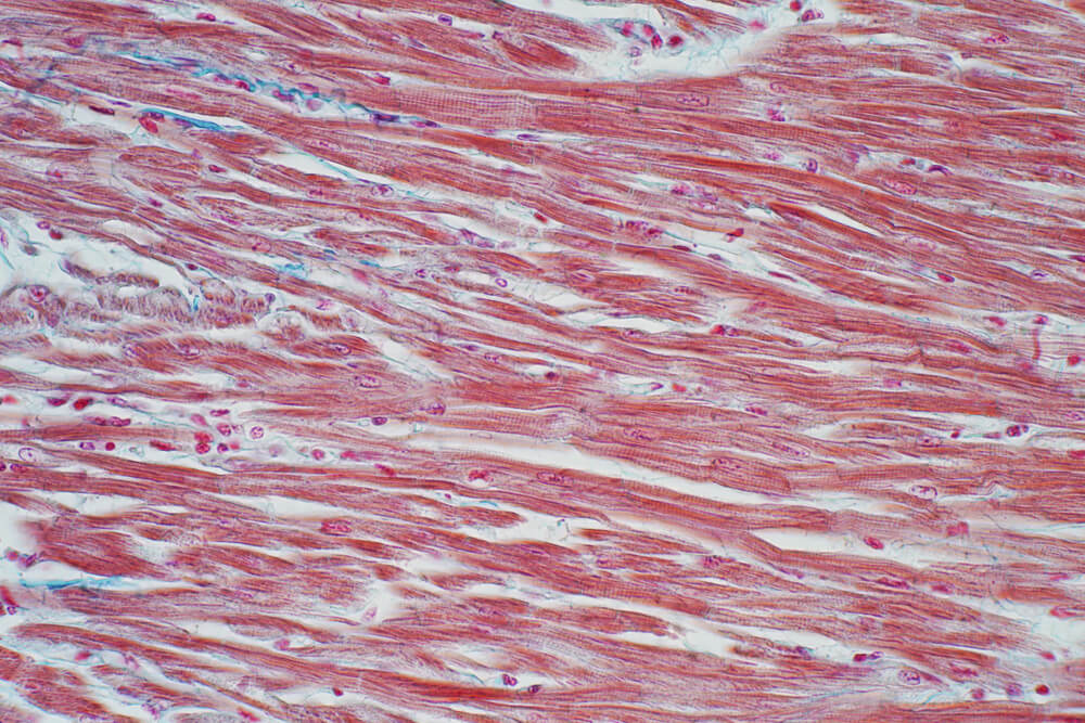 Histology of human cardiac muscle under microscope view